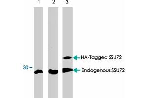 Western blot analysis using SSU72 polyclonal antibody  on MCF-7 (1), COS-7 (2) and COS-7 cells transfected with HA-Tagged SSU72 protein (3). (SSU72 抗体)