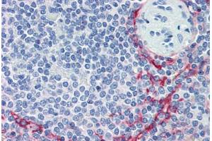 Human Spleen (formalin-fixed, paraffin-embedded) stained with MADCAM1 antibody ABIN462006 at 10 ug/ml followed by biotinylated anti-mouse IgG secondary antibody ABIN481714, alkaline phosphatase-streptavidin and chromogen. (MADCAM1 抗体)