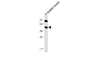 Anti-KERA Antibody (C-term) at 1:1000 dilution + Human skeletal muscle lysate Lysates/proteins at 20 μg per lane. (KERA 抗体  (C-Term))