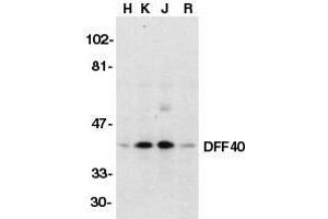 Western blot analysis of DFF40/CAD in HeLa (H), K562 (K), Jurkat (J), and Raji (R) whole cell lysate with DFF40/CAD antibody at 1μg/ml.