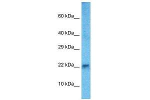 Host:  Rabbit  Target Name:  Hand2  Sample Type:  Mouse Heart lysates  Antibody Dilution:  1. (HAND2 抗体  (C-Term))
