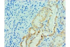 Immunohistochemistry of paraffin-embedded human kidney tissue using ABIN7165064 at dilution of 1:100 (PRMT1 抗体  (AA 20-353))