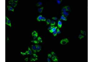 Immunofluorescence staining of PC-3 cells with ABIN7166148 at 1:266, counter-stained with DAPI. (SPRY1 抗体  (AA 1-178))