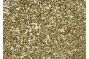 ABIN6272552 at 1/100 staining Mouse pancreas tissue by IHC-P. (MYCBP 抗体  (N-Term))