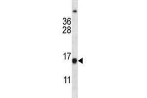 Western Blotting (WB) image for anti-B-Cell CLL/lymphoma 2 (BCL2) (AA 86-114) antibody (ABIN3030099)