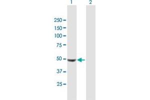 Western Blot analysis of UCKL1 expression in transfected 293T cell line by UCKL1 MaxPab polyclonal antibody. (UCKL1 抗体  (AA 1-419))