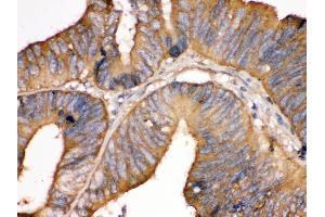 Immunohistochemistry (Paraffin-embedded Sections) (IHC (p)) image for anti-TF (AA 20-49), (N-Term) antibody (ABIN3043419) (TF (AA 20-49), (N-Term) 抗体)
