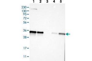 Western blot analysis of Lane 1: RT-4, Lane 2: U-251 MG, Lane 3: Human Plasma, Lane 4: Liver, Lane 5: Tonsil with KCTD10 polyclonal antibody  at 1:250-1:500 dilution. (KCTD10 抗体)