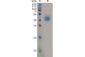 SDS-PAGE (SDS) image for Chemokine (C-C Motif) Receptor 4 (CCR4) (AA 1-39) protein (Fc Tag) (ABIN6964144)