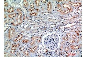 Immunohistochemical analysis of paraffin-embedded human-kidney, antibody was diluted at 1:200 (CD56 抗体  (Internal Region))