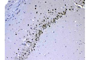 IHC analysis of CHD2 using anti-CHD2 antibody . (CHD2 抗体  (AA 1124-1351))