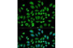 Immunofluorescence analysis of HeLa cells using PDE4D Polyclonal Antibody (PDE4D 抗体)