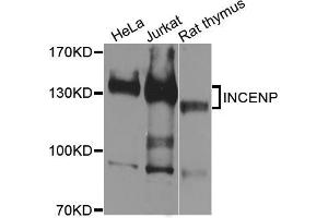 Western blot analysis of extracts of various cell lines, using INCENP antibody (ABIN5996452) at 1/1000 dilution. (INCENP 抗体)