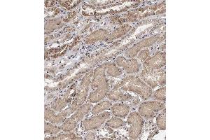 Immunohistochemical analysis of (ABIN391585 and ABIN2841517) on paraffin-embedded Human kidney tissue. (TECPR1 抗体  (C-Term))