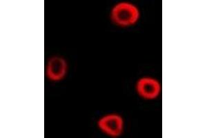 Immunofluorescent analysis of IRSp53 staining in A549 cells. (BAIAP2 抗体)