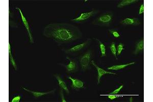 Immunofluorescence of purified MaxPab antibody to PDHA2 on HeLa cell. (PDHA2 抗体  (AA 1-388))