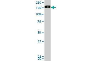 MLLT10 monoclonal antibody (M01), clone 6H8. (MLLT10 抗体  (AA 695-793))