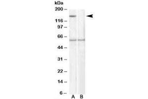 Western blot testing of human EBV-immortilized lymphoblastoid lysate with SIPA1 antibody at 1ug/ml, with (B) and without (A) immunizing peptide. (SIPA1 抗体)
