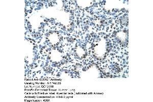 Immunohistochemistry (IHC) image for anti-Semenogelin I (SEMG1) (N-Term) antibody (ABIN2777136)
