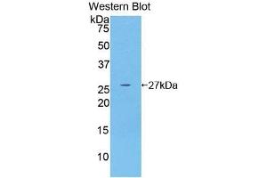 Detection of Recombinant GSTm4, Human using Polyclonal Antibody to Glutathione S Transferase Mu 4 (GSTm4) (GSTM4 抗体  (AA 18-215))