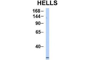Host:  Rabbit  Target Name:  HELLS  Sample Type:  MCF7  Antibody Dilution:  1. (HELLS 抗体  (Middle Region))