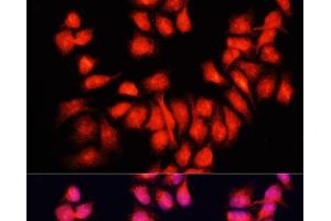 Immunofluorescence analysis of HeLa cells using BMP6 Polyclonal Antibody at dilution of 1:100. (BMP6 抗体)