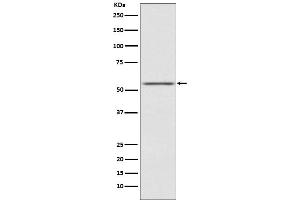 Western blot analysis of AMHR2 expression in SK-OV-3 cell lysate.
