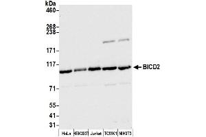 anti-Bicaudal D Homolog 2 (BICD2) (AA 375-425) antibody