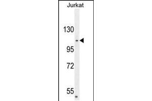 Western blot analysis in Jurkat cell line lysates (35ug/lane). (CENPC1 抗体  (AA 441-467))