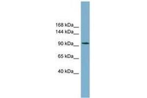 Image no. 1 for anti-Solute Carrier Family 12 (Sodium/Chloride Transporters), Member 3 (SLC12A3) (C-Term) antibody (ABIN6743198)