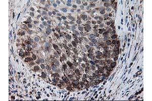 Image no. 5 for anti-Dihydrolipoamide Dehydrogenase (DLD) antibody (ABIN1497846) (DLD 抗体)