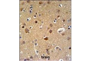 TELO2 Antibody (C-term) (ABIN651003 and ABIN2840034) IHC analysis in formalin fixed and paraffin embedded brain tissue followed by peroxidase conjugation of the secondary antibody and DAB staining. (TELO2 抗体  (C-Term))