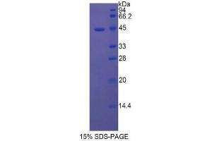 SDS-PAGE of Protein Standard from the Kit (Highly purified E. (TPSAB1 ELISA 试剂盒)