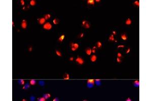 Immunofluorescence analysis of HeLa cells using FXN / FRataxin Polyclonal Antibody at dilution of 1:100 (40x lens). (Frataxin 抗体)