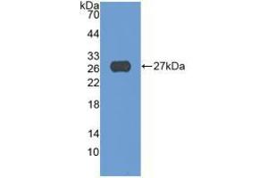 Western blot analysis of recombinant Human ADAM17. (ADAM17 抗体  (AA 226-473))