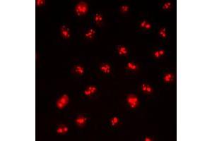 Immunofluorescent analysis of CDYL2 staining in HepG2 cells. (CDYL2 抗体  (N-Term))