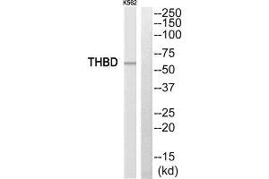 Western Blotting (WB) image for anti-Thrombomodulin (THBD) (C-Term) antibody (ABIN1852276) (Thrombomodulin 抗体  (C-Term))