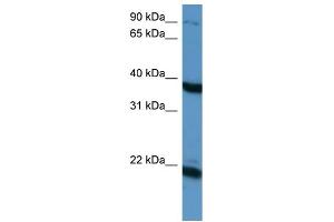 WB Suggested Anti-PTN Antibody Titration: 0. (Pleiotrophin 抗体  (C-Term))