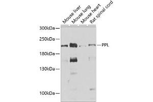 Western blot analysis of extracts of various cell lines, using PPL antibody (ABIN6128532, ABIN6146036, ABIN6146038 and ABIN6222699) at 1:1000 dilution. (PPL 抗体  (AA 1-130))