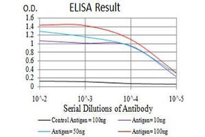 Black line: Control Antigen (100 ng), Purple line: Antigen(10 ng), Blue line: Antigen (50 ng), Red line: Antigen (100 ng), (HDAC4 抗体  (AA 456-592))