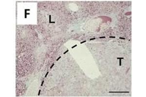 Immunostaining (ISt) image for anti-Hepatitis B Virus Surface Antigen (HBsAg) antibody (ABIN285516)