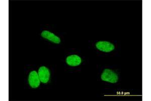 Immunofluorescence of monoclonal antibody to HOXA11 on HeLa cell. (Homeobox A11 抗体  (AA 60-166))