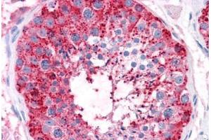 Human Testis: Formalin-Fixed, Paraffin-Embedded (FFPE) (ADAM20 抗体  (Internal Region))