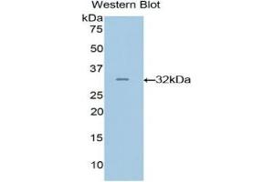 Detection of Recombinant GRAP2, Mouse using Polyclonal Antibody to GRB2 Related Adaptor Protein 2 (GRAP2) (GRAP2 抗体  (AA 20-262))