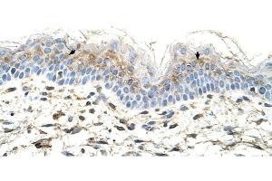 S100A3 antibody was used for immunohistochemistry at a concentration of 4-8 ug/ml to stain Squamous epithelial cells (arrows) in Human Skin. (S100A3 抗体  (N-Term))