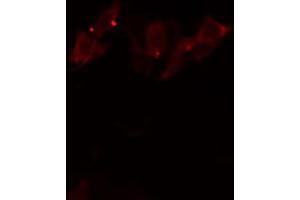Immunofluorescence (fixed cells) (IF/ICC) image for anti-Cytochrome P450, Family 2, Subfamily S, Polypeptide 1 (CYP2S1) (Internal Region) antibody (ABIN6258505)