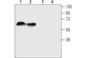 Western blot analysis of mouse (lanes 1 and 3) and rat (lanes 2 and 4) brain lysates: - 1-2. (SLC6A4 抗体  (4th Extracellular Loop))