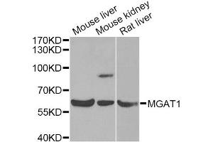 Western blot analysis of extracts of various cell lines, using MGAT1 Antibody (ABIN5975025) at 1/1000 dilution. (MGAT1 抗体)