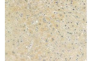 ABIN6260180 and ABIN6279191 at 1/100 staining human normal liver tissue by IHC-P. (BAAT 抗体  (N-Term))