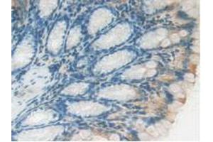 IHC-P analysis of Mouse Intestine Tissue, with DAB staining.